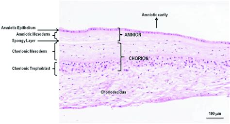 An Injury That Separates Various Layers