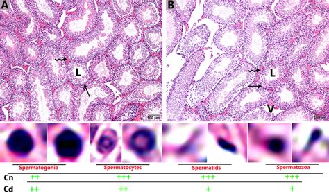 Light Microscopy Of The Seminiferous Tubules Of Testis A Control And B