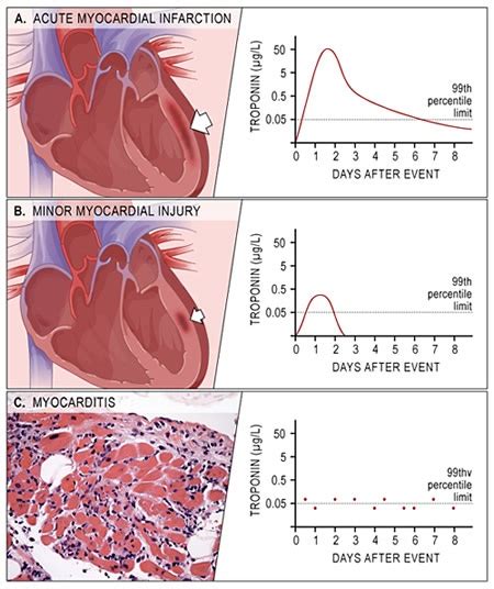 Pin by Elizabeth on Pathophysiology | Pinterest