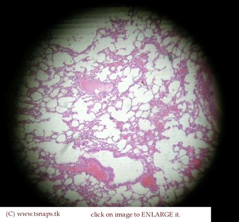 Histology Slides Database Lung Histology Slide