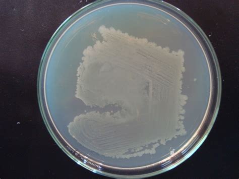 Colony Morphology Of Bacillus Sp Cs14 Download Scientific Diagram