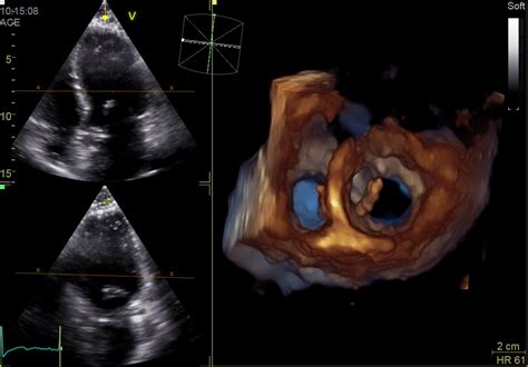 Consultul cardiologic la copii şi tineri Ce boli pot fi depistate şi