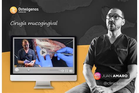 Curso Online Cirug A Mucogingival