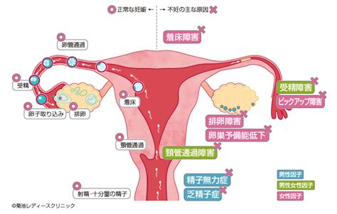 不妊治療がはじめての方 菊池レディースクリニック