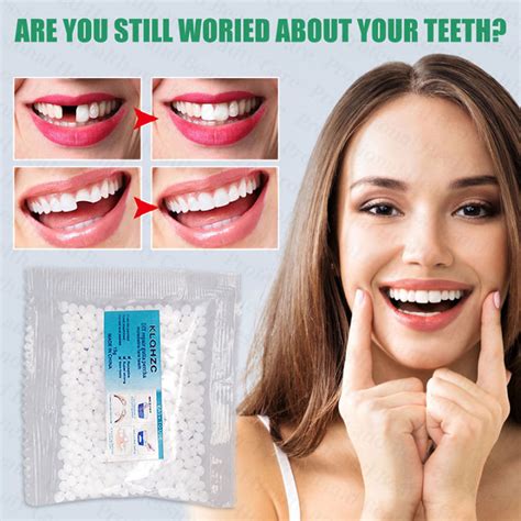 【fast Filling】diy Tooth Repair Kit Temporary Tooth Repair Kit 50g