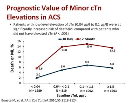 Cardiac Troponin Defining The 99th Percentile Reference Limit For Mi