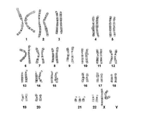 Solved Question Examine The Karyotype Shown Here Select Chegg