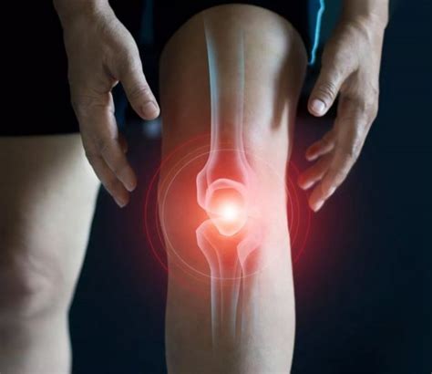 Exactech Knee Hip And Ankle Replacement Recall The Ruth Law Team