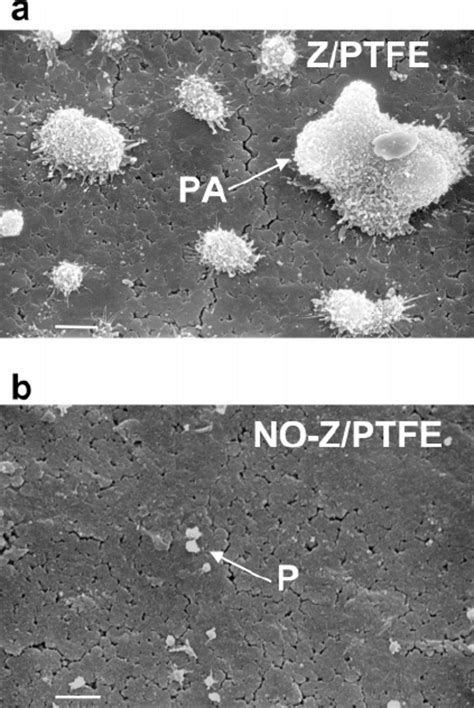 Scanning Electron Micrographs Of The Surface Of A Untreated Co