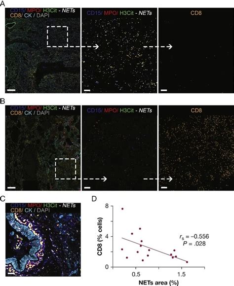 PhenoImager多重荧光免疫组化技术应用于COVID19研究再添新成果 揭示COVID 19重症患者支气管组织损伤机制 云准医药科技