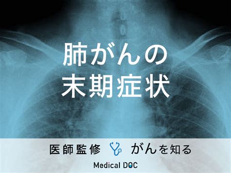 「肺がんの末期症状」はご存知ですか？初期症状や余命も解説！【医師監修】 ライブドアニュース