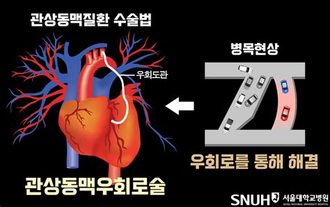 서울대학교병원