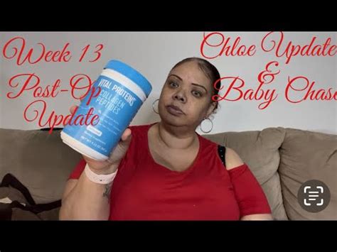 13th Week Post Op Update VSG Gastric Sleeve Gastric Bypass VSG