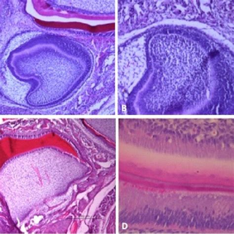 Morphological view of the stages of tooth formation. In A, the bell ...