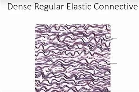 Elastic Connective Tissue Drawing