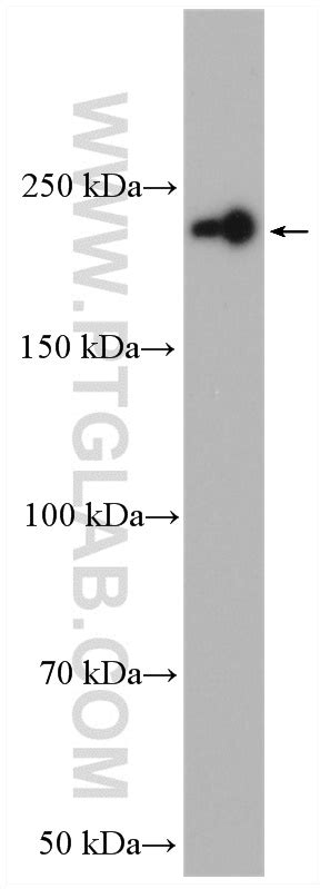 Pi4ka Antibody 12411 1 Ap Proteintech 武汉三鹰生物技术有限公司