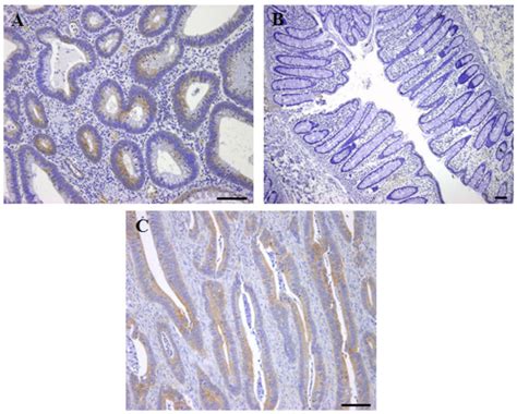 Immunohistochemical Expression Of Cdw A Section From Colorectal