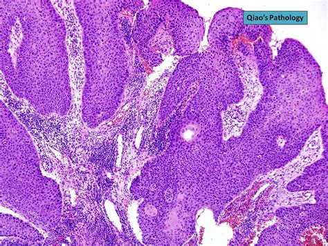 Histology Of Larynx