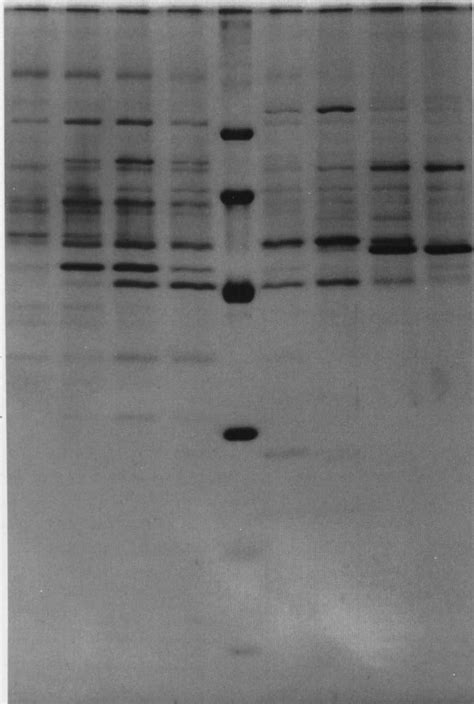 SDS PAGE Analysis Of Purified Chitin Synthase Selected Fractions From