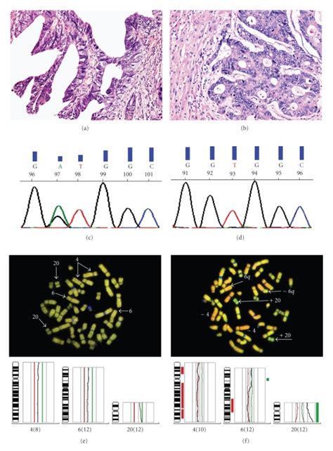 Further Analysis Of Biopsies From The Patient With A Discordant Kras