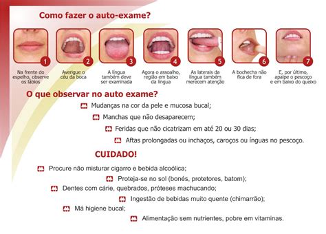Secretaria Municipal De Saúde De Herval Doeste CÂncer De Boca Como