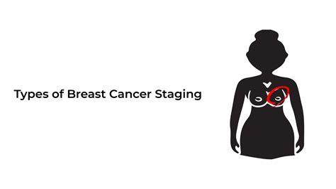 Types of Breast cancer staging ~ Healthcare City