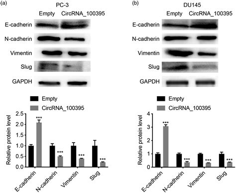 Inhibitory Role Of Circrna In The Proliferation And Metastasis