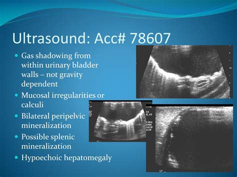 PPT - Emphysematous cystitis PowerPoint Presentation, free download - ID:2241406