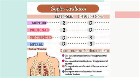 Soplos Cardíacos Cecilia Cruz uDocz