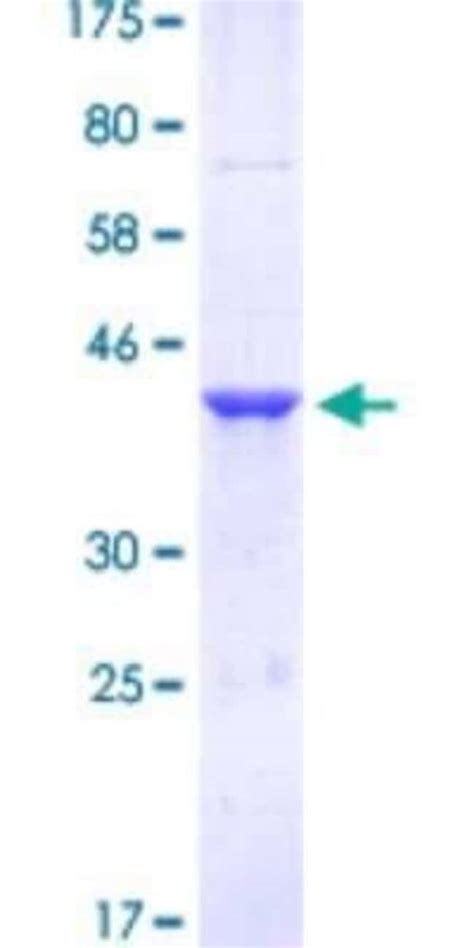 Novus Biologicals Recombinant Human FoxM1 GST N Term Protein 25 μg