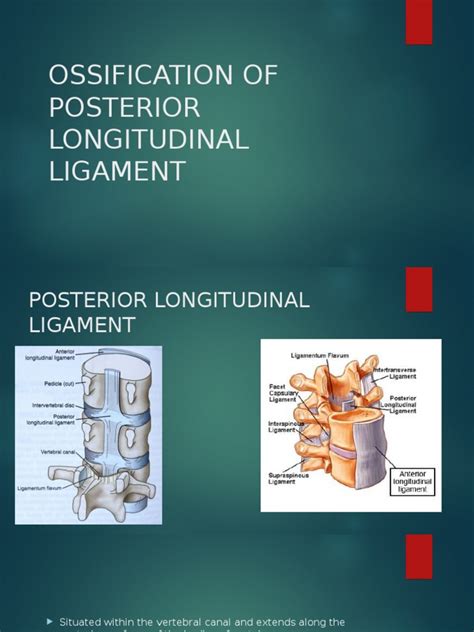 Pdf Ossification Of Posterior Longitudinal Ligament Dokumen Tips