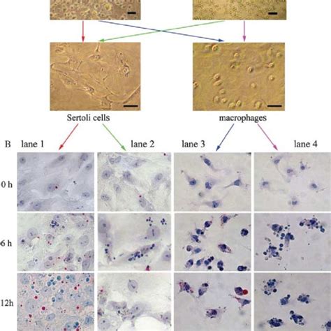 Comparison Of Lipid Droplet Formation In Sertoli Cells At Different