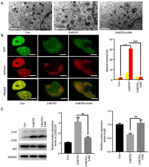 3 MA Autophagy Inhibitor Abolishes 3 MCPD Induced Autophagy A