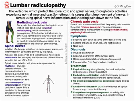 Lumbar radiculopathy. The vertebrae, which protect the spinal… | by Dr ...