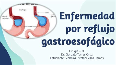 ERGE Resumenesmedicos100 UDocz