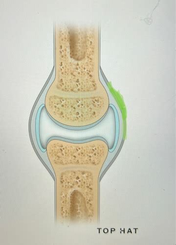 Synovial Joints Flashcards Quizlet