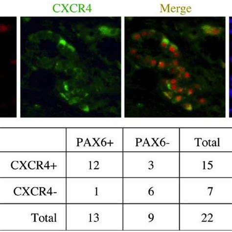 PAX6 And CXCR4 Are Expressed In Primary Human Pancreatic Cancer Tissue