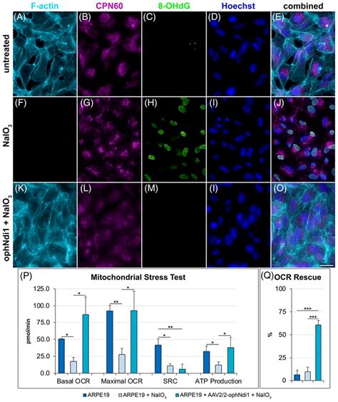 Clin Transl Med：一种新型基因疗法有望治疗老年性黄斑变性线粒体细胞功能