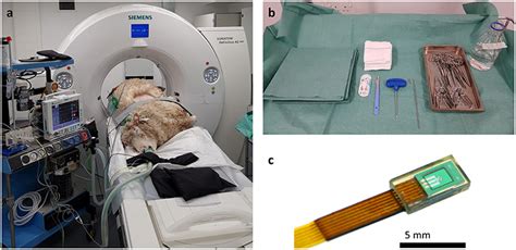 Frontiers A Novel Translational Ovine Pulmonary Adenocarcinoma Model