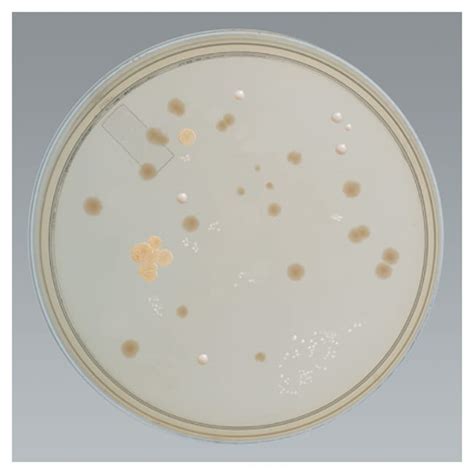 Thermo Scientific™ Settling Plate Tryptic Soy Agar Prepared Media Plates Microbiology Media