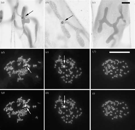 Sex Chromatin In Interphase Nuclei Of Last Instar Larvae A C