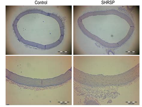 Vascular Reactivity In Old Spontaneously Hypertensive Stroke Prone Rats