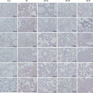 IHC Image Of Key Proteins Of The Notch Pathway In The Lung Tissues Of