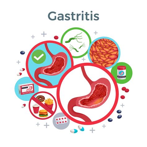 Gastritis Treatment - Best Treatment for Gastritis