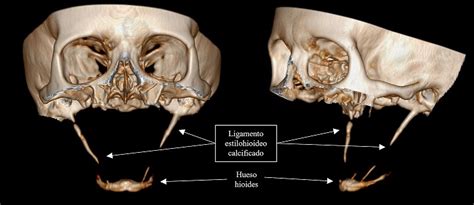 Caso E ImÁgenes