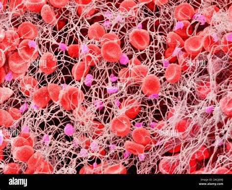 Blood Clot Coloured Scanning Electron Micrograph SEM Of A Blood Clot