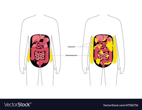 Visceral Fat Diagram Royalty Free Vector Image