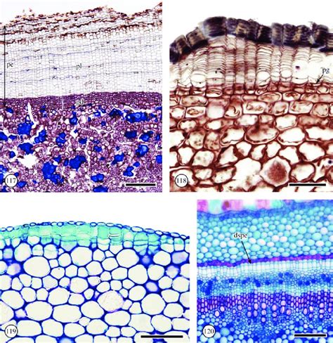 periderm transverse sections  periderm pe