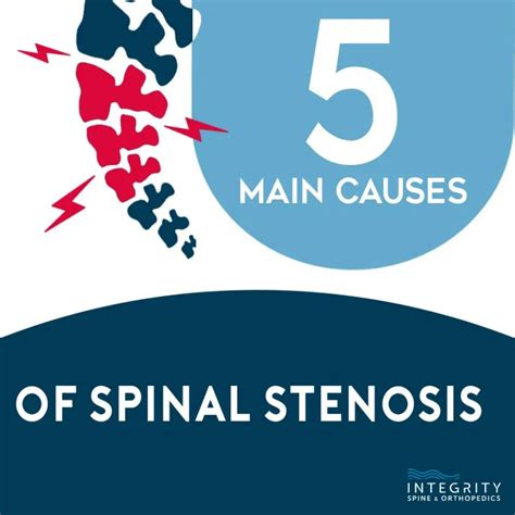 5 Causes of Spinal Stenosis | Orthopedic Surgeons located in Jacksonville and Middleburg, FL ...