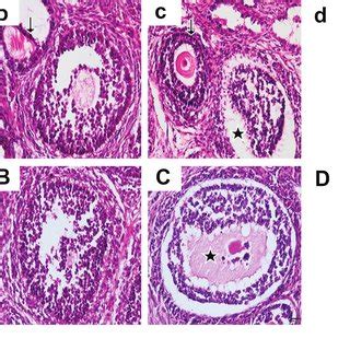 He Staining Of Ovarian Sections Observed Under X Microscope Pictures